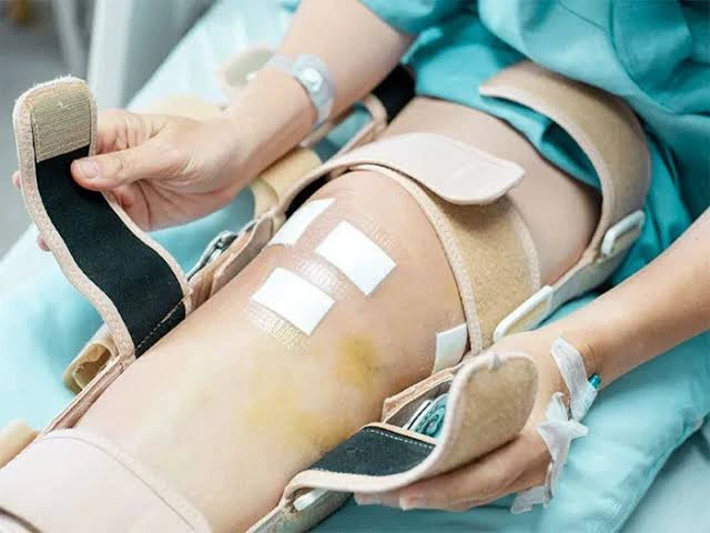 توانبخشی بعد از جراحی تعویض مفصل زانو