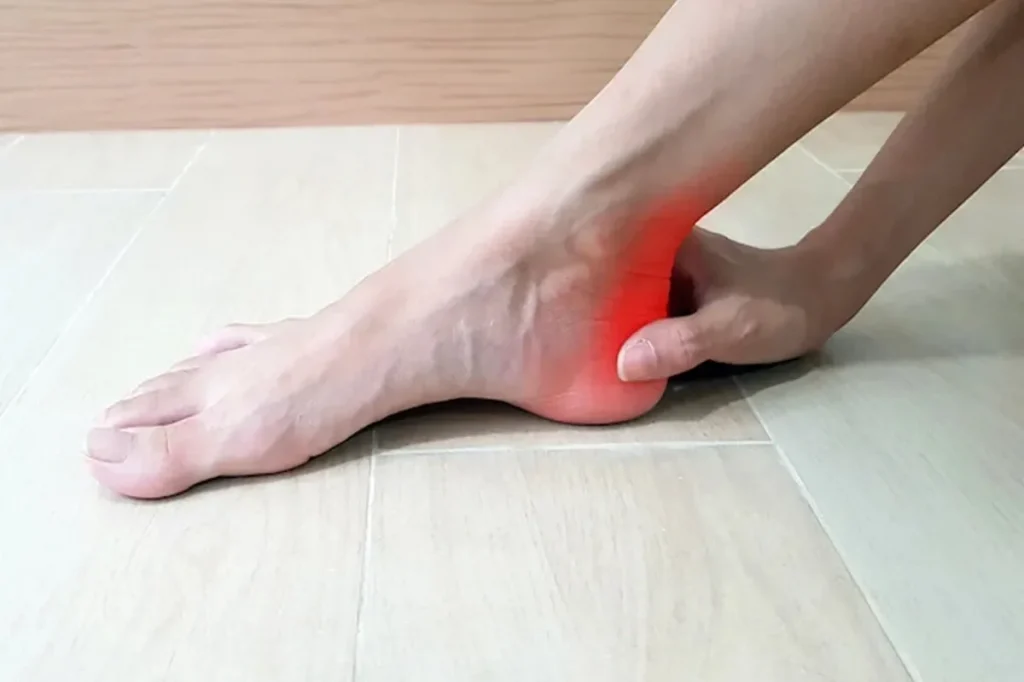 التهاب تاندون آشیل